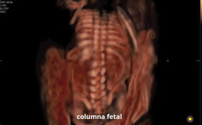 columna fetal