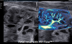 Fetal renal