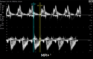 MPI