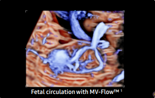 fetal circulation