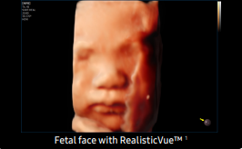 fetal face