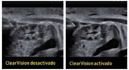 riñon fetal