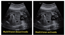 abdomen fetal