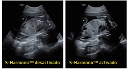 abdomen fetal2