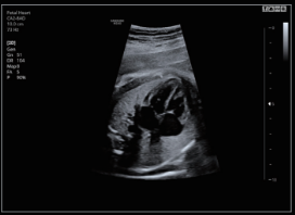 Corazón fetal