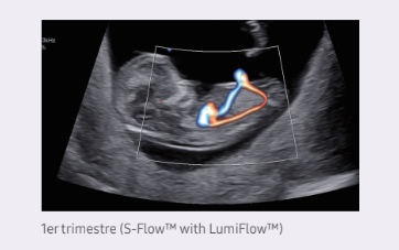 1er trimestre (S-FlowTM with LumiFlowTM)