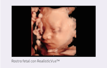 Rostro fetal con RealisticVueTM