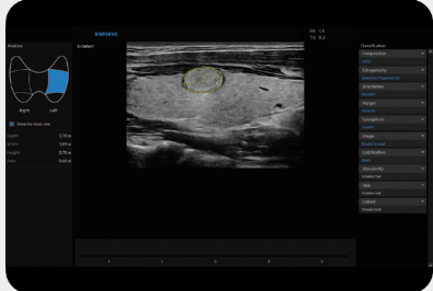 S-DetectTM 1, 2for Thyroid