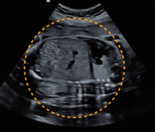 fetal-abdomen2