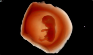 1.er trimestre en CrystalVue™¹