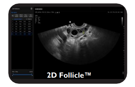 2d Follicle