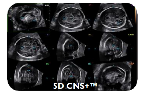 5D CNS