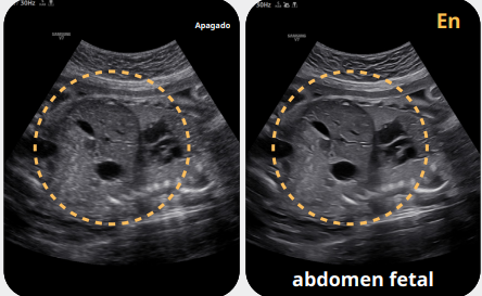 abdomen fetal