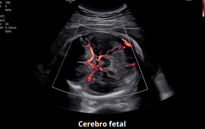 Cerebro fetal
