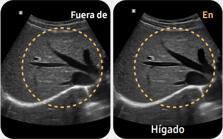Hígado