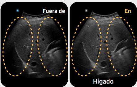 Hígado
