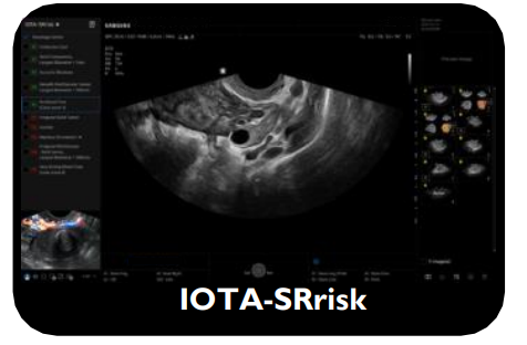 iota-srrisk