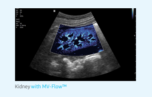 mv-flowv8